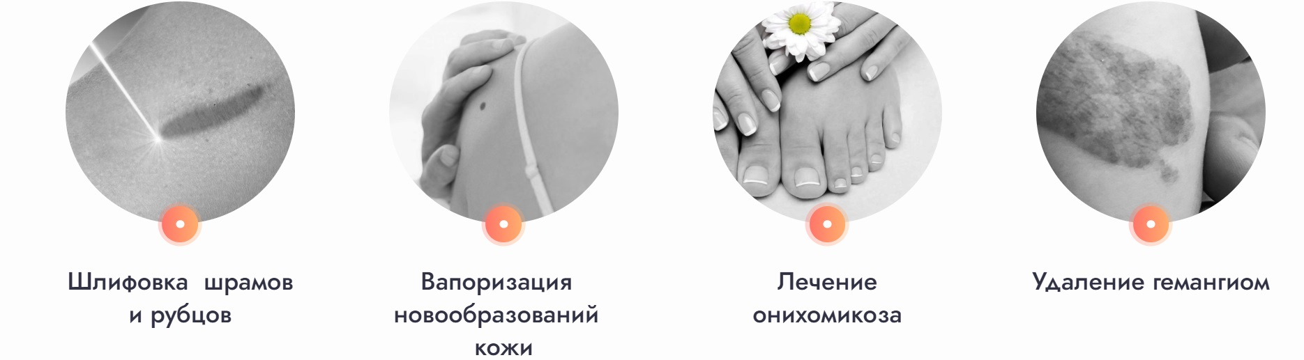 Применения лазера - 3
